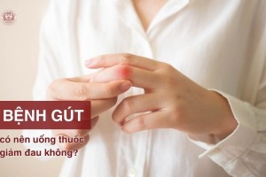 [Tư vấn] Bệnh “Gút” có nên uống thuốc giảm đau không?